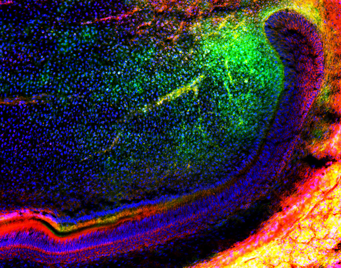 Tooth mesenchymal stem cells700x550